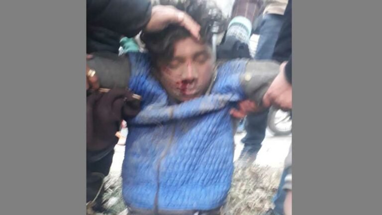 BikeInjured_Sikanderpur