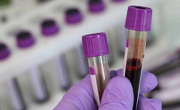 Block Public Health Unit Lab inaugurated in Belthara
