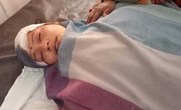 कुकर फटने से विवाहिता महिला गंभीर रूप से घायल