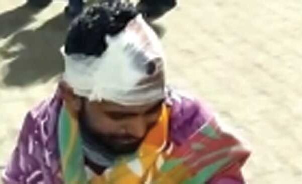 Violent scuffle, eight injured in Piprauli