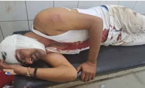 Ballia Man Attacked twice
