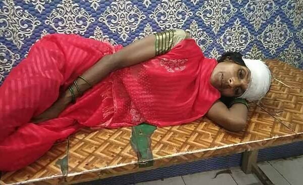 Belthra Mahila Ghayal